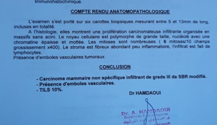 CANCER DE SEIN Mme Halimi Ait Snane Tinghir