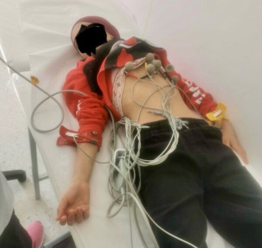 Enfant, atteint d’hypoplasie pulmonaire en Tunisie
