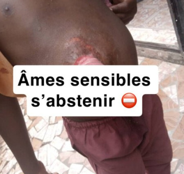 Aidez un petit garçon de 5 ans à vivre