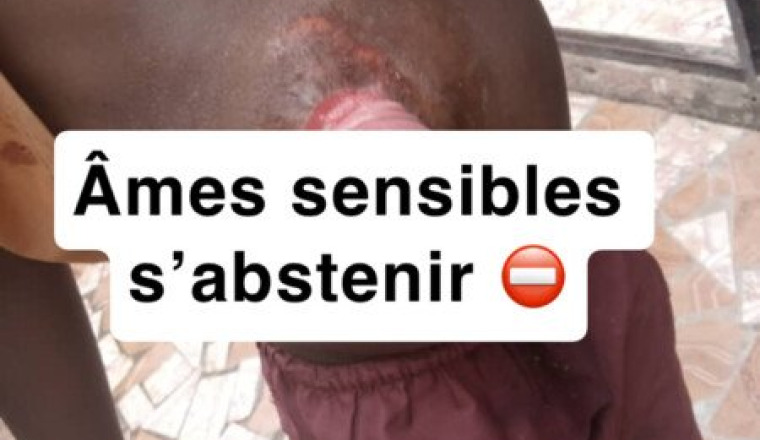 Aidez un petit garçon de 5 ans à vivre