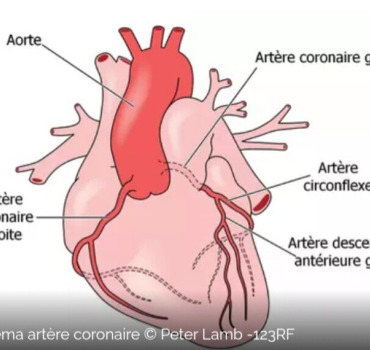 Opération au cœur
