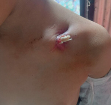 🆘 URGENTE OPÉRATION POUR CE PETIT GARÇON ! 💔