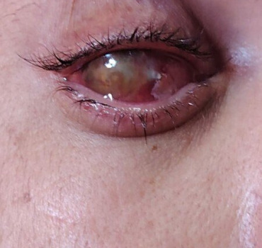 Urgence médicale: opération oeil(Khalid)