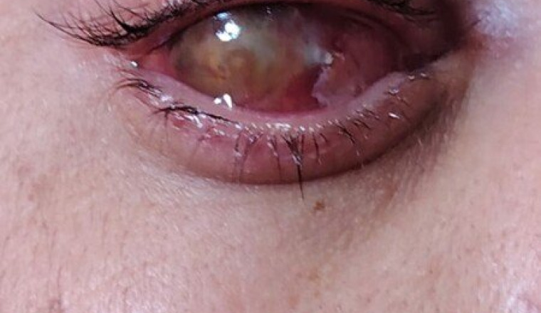 Urgence médicale: opération oeil(Khalid)