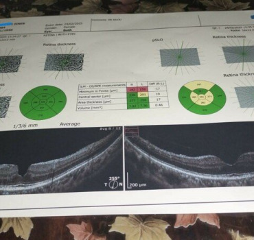 Opération d'urgence aux yeux pour parents au Maroc