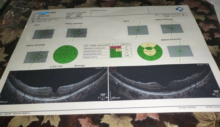 Opération d'urgence aux yeux pour parents au Maroc