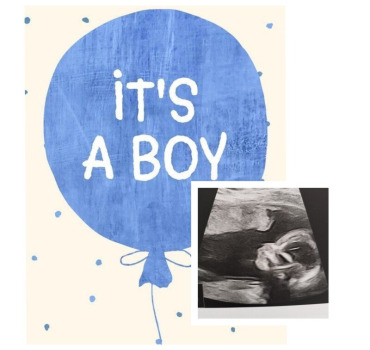 Bienvenue Bébé 💙