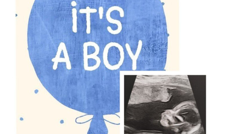 Bienvenue Bébé 💙