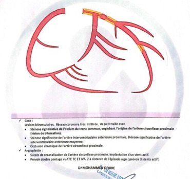 Frais chirurgie cardiaque urgente
