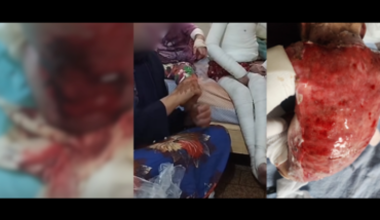 maman, seule, 2 filles en extrême souffrance