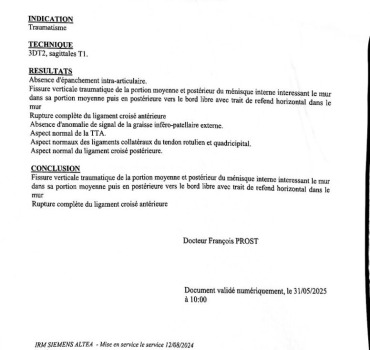 Opération rupture ligamentaire