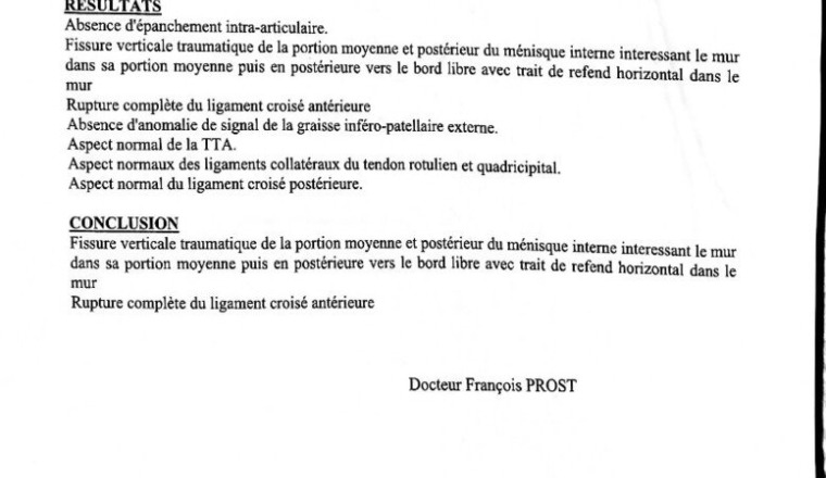 Opération rupture ligamentaire