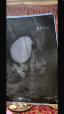 Fundraising proof image