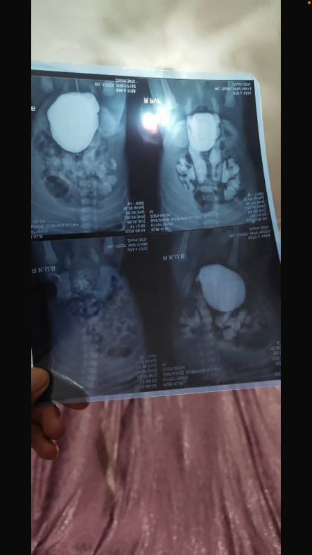 Fundraising proof image