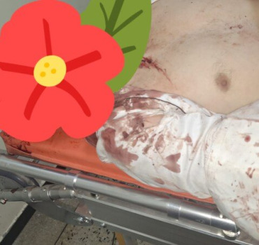 Urgence pour hammou