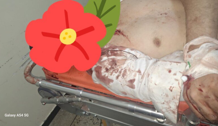 Urgence pour hammou