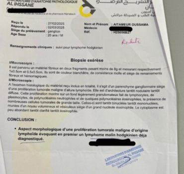 Cagnotte pour Oussama contre le cancer
