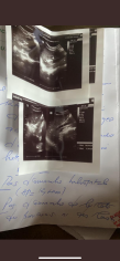 Image justificative de la cagnotte