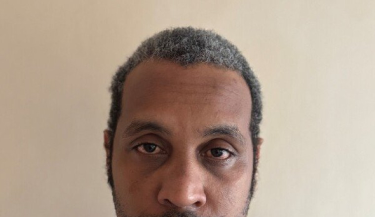Osman Abdulrazaq Surgery
