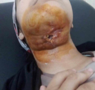 Urgence vital pour une jeune fille en Algérie