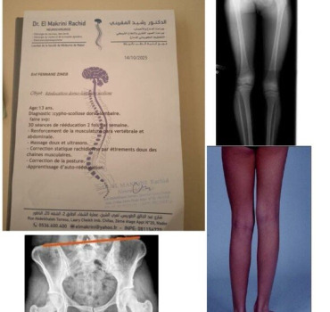 Aidons Zineb à acheter sa chaussure de correction