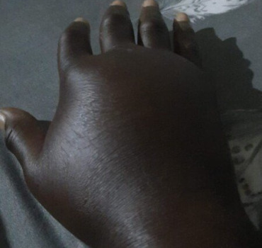 Soutien urgent pour les soins d’Abdoulaye Condé