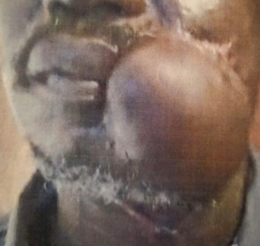 Cagnotte pour notre frère DIAGNE