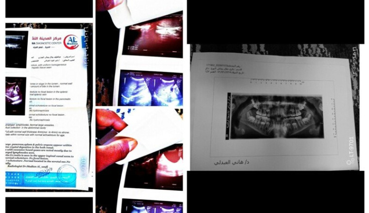 Urgences médicales pour 2 enfants