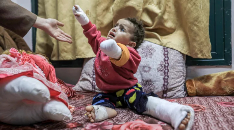 Des prothèses aux enfants amputés de GAZA 🆘🇵🇸