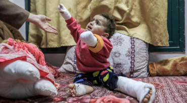 Des prothèses aux enfants amputés de GAZA 🆘🇵🇸