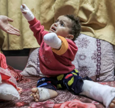 Des prothèses aux enfants amputés de GAZA 🆘🇵🇸