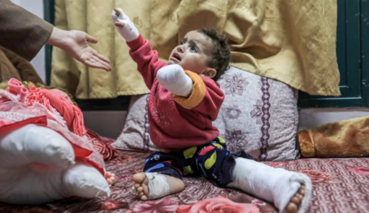Des prothèses aux enfants amputés de GAZA 🆘🇵🇸