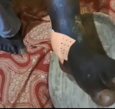 🏥 Aidons notre frère à remarcher 🇬🇳 Opération