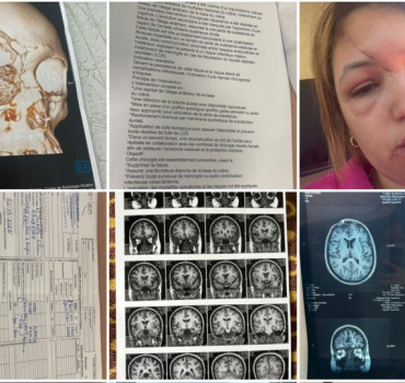 Aidez siham à retrouver son visage