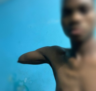 Un bras pour aboulaye