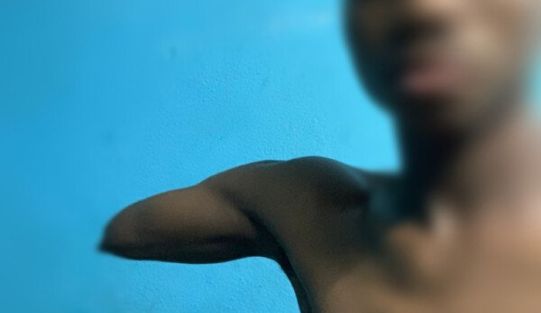 Un bras pour aboulaye