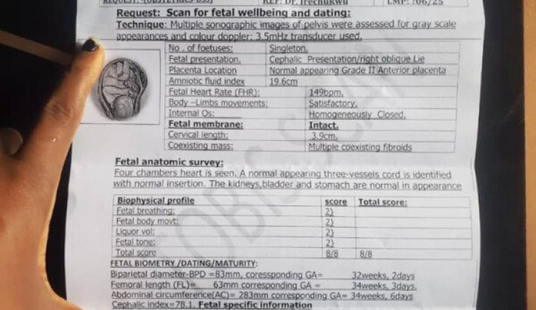 Urgence césarienne – aidons une maman et son bébé