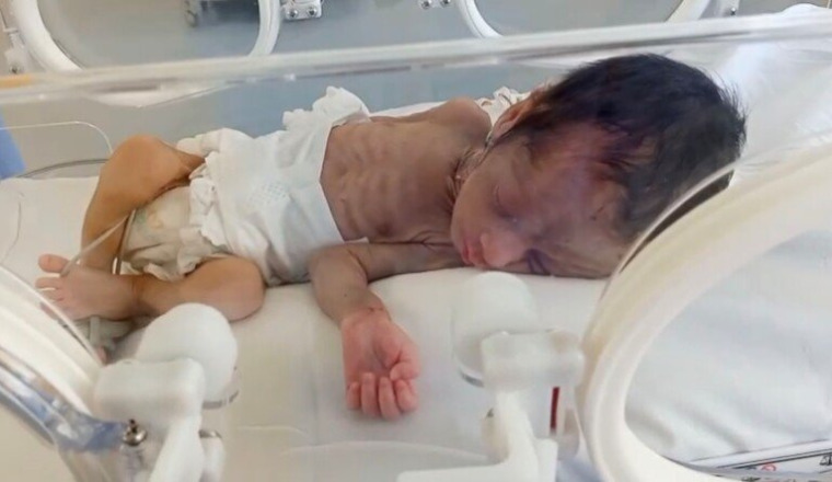 Un bébé malade a besoin de votre aide EN URGENCE