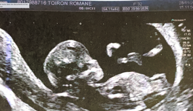 Liste de naissance - Bébé Romane & Marc