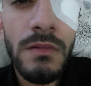 Aidons mohamed, atteint d'une altération oculaire