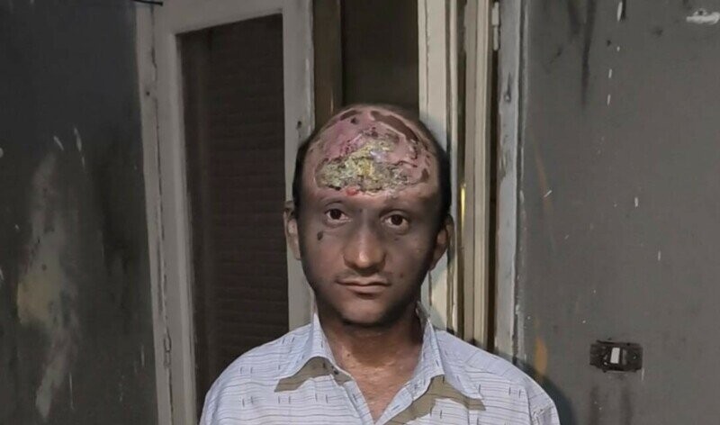 Aidons Mohamed atteint d'un cancer !