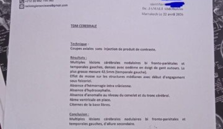 Opération tumeur pour Lalla Sfia