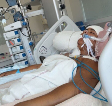 Aidez-moi à remarcher après un accident