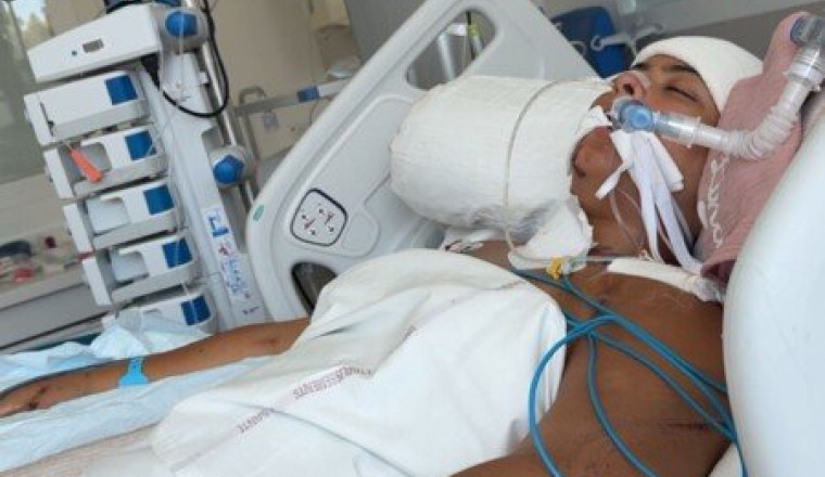 Aidez-moi à remarcher après un accident